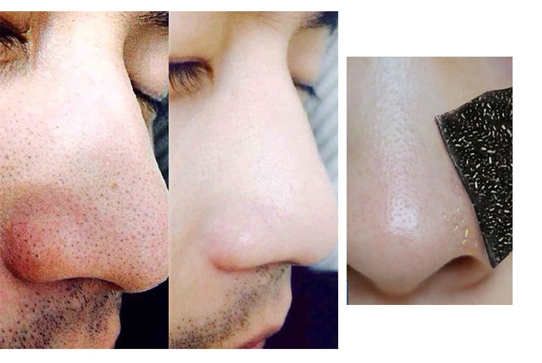 ClearLift Charcoal Nose Strips – Blackhead Removal Pore Cleansing Strips (10-Pack)