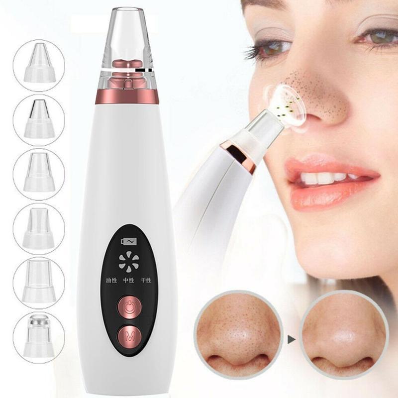 GlowSculpt Pore Vacuum – White Blackhead Remover Device with LED Display and 5 Suction Heads